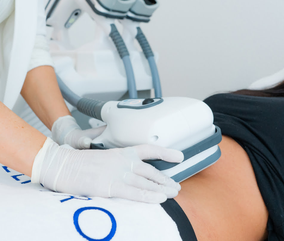 KRYOLIPOLYSE BEHANDLUNG – ABLAUF